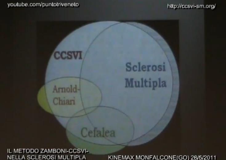 Distribuzione della CCSVI - dott. Fabrizio Salvi